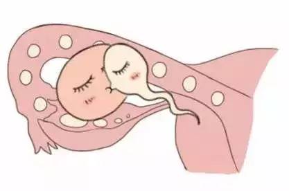 人工孕妈代怀咨询联系电话